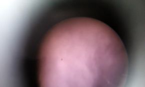 前些天云缝中拍到的太阳和黑子处女作