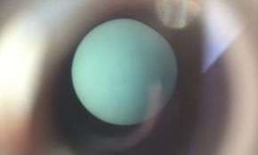 太阳黑子.黑子有米有!!有米有呀!!!