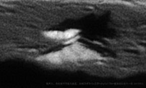 模模糊糊小山峰
